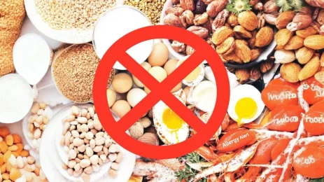 How to Identify and Manage Food Allergies in Your Diet