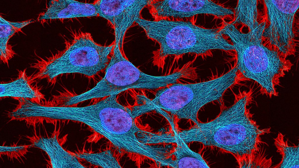 Henrietta Lacks’ estate settles with Novartis over immortality cells