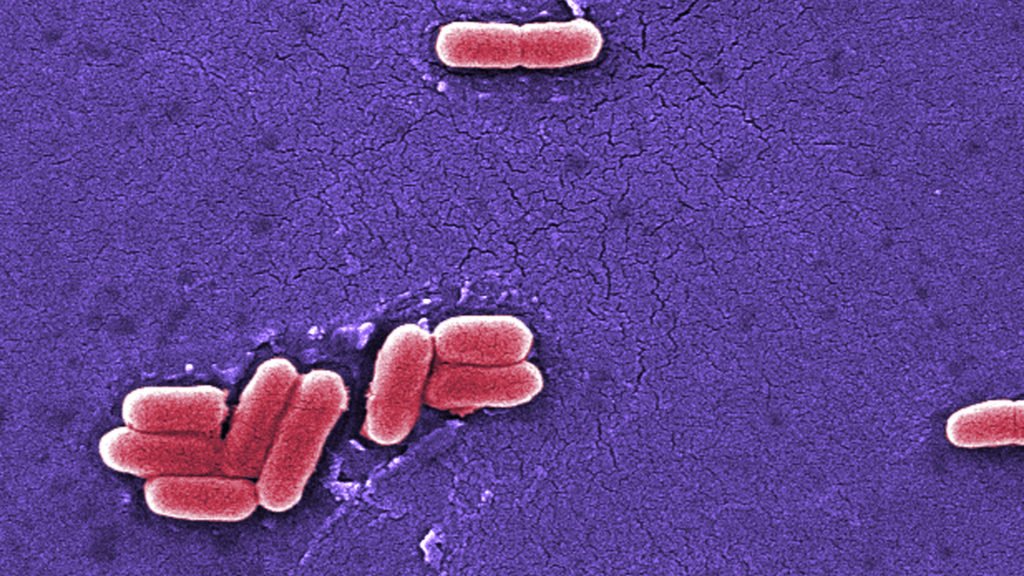 raw dairy products, e. E. coli, infant formula, and food safety: Morning rounds raw dairy products, e. E. coli, infant formula, and food safety: Morning rounds