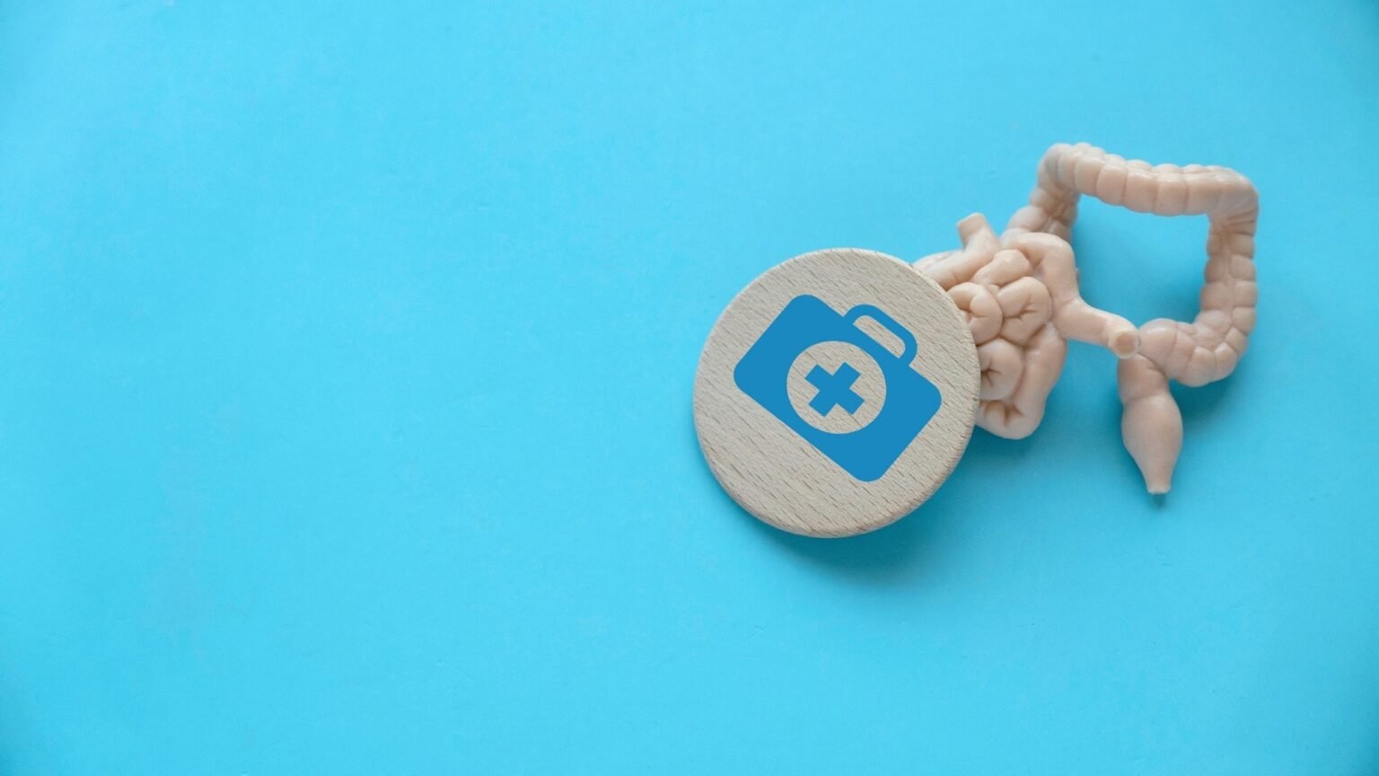 High doses of curcumin fail to produce lasting changes in the gut microbiota of IBD patients