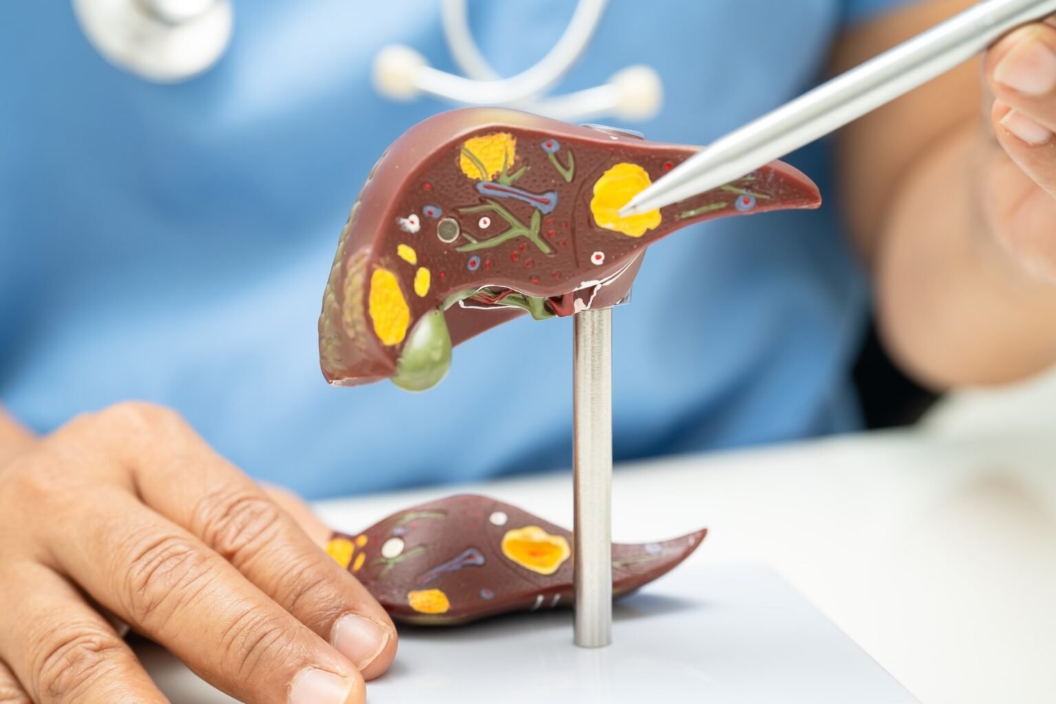Palmatine improved fatty liver markers in a preclinical study of type 2 diabetes