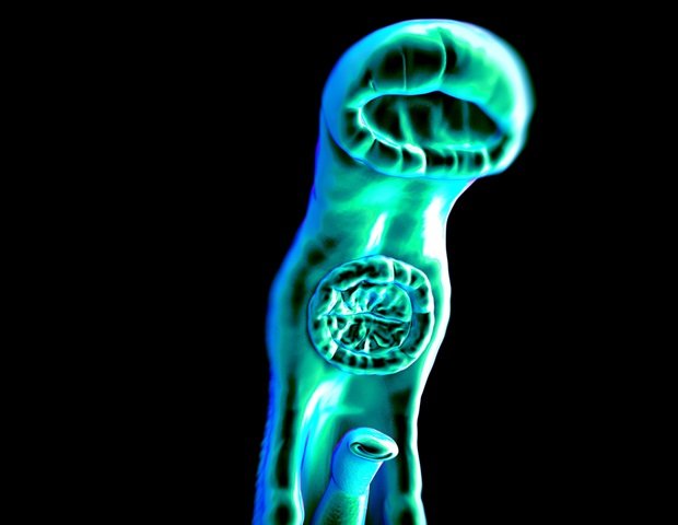 Precise mapping identifies schistosomiasis hotspots in your home Precise mapping identifies schistosomiasis hotspots in your home