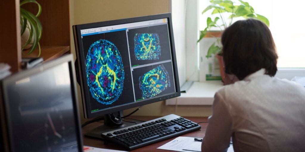 Study finds that severe emotional outbursts in ADHD are linked to distinct brain differences