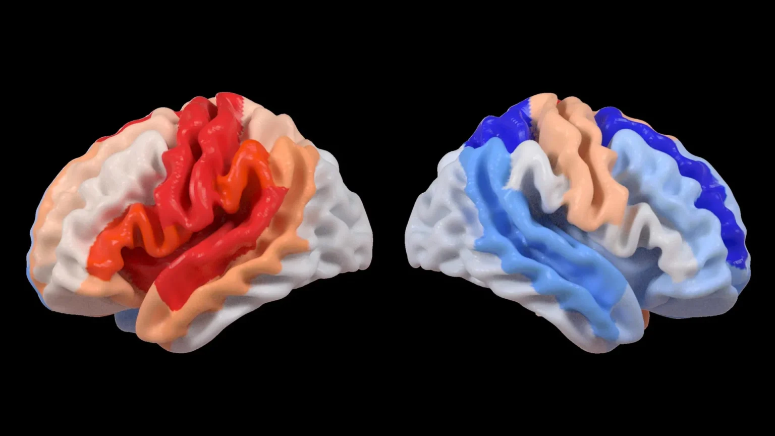 Stroke causes hidden brain changes that look like rejuvenation