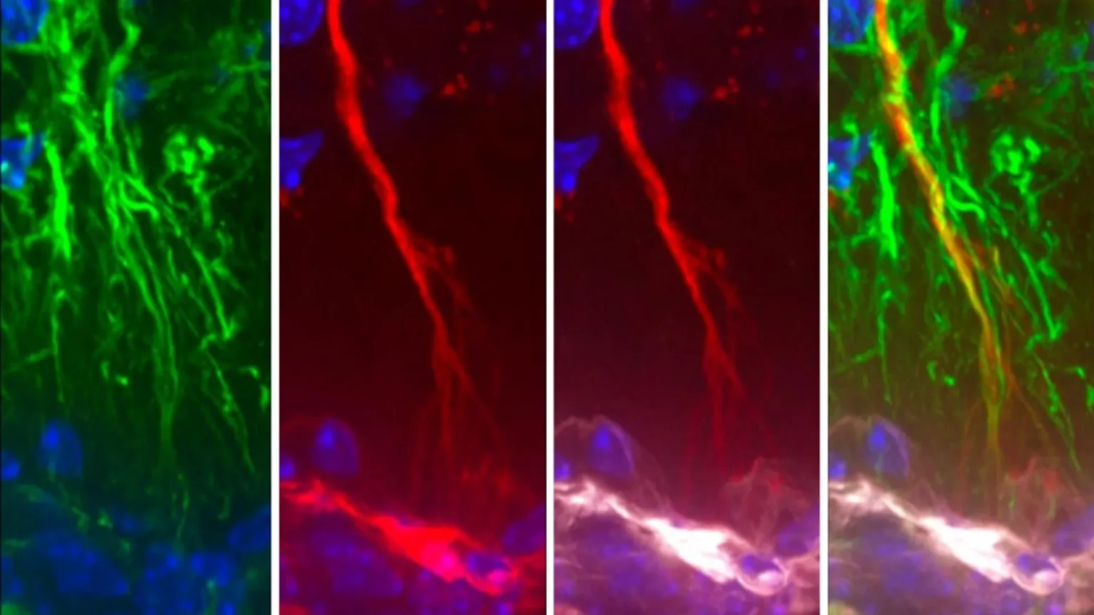 Scientists discover hidden brain cells that may stop tau buildup in Alzheimer’s disease