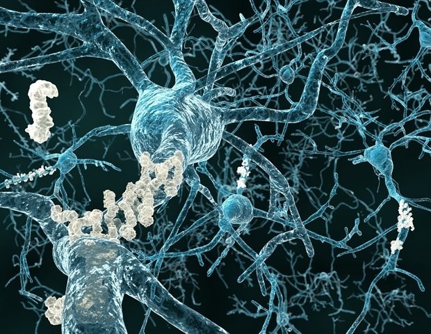 New combination therapy points to safer approach to Alzheimer’s disease treatment New combination therapy points to safer approach to Alzheimer’s disease treatment