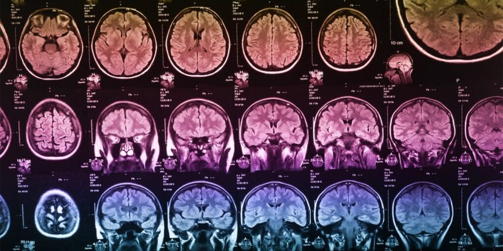 Different types of childhood abuse appear to uniquely shape human brain development