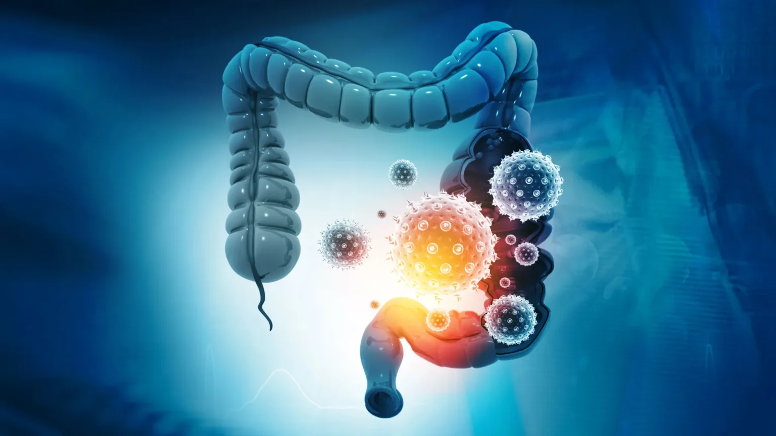 What’s hidden inside colon cancer could change treatment
