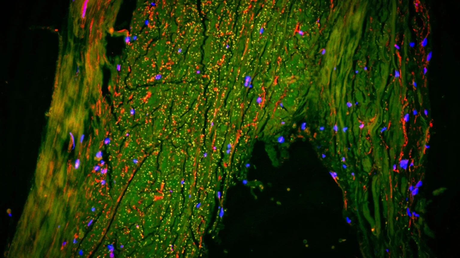 Scientists have discovered a hidden ‘drainage channel’ in the human brain Scientists have discovered a hidden ‘drainage channel’ in the human brain