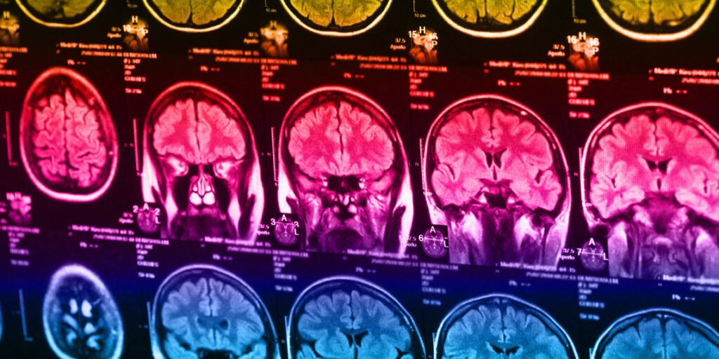 Increased BMI in young people is associated with changes in brain connectivity