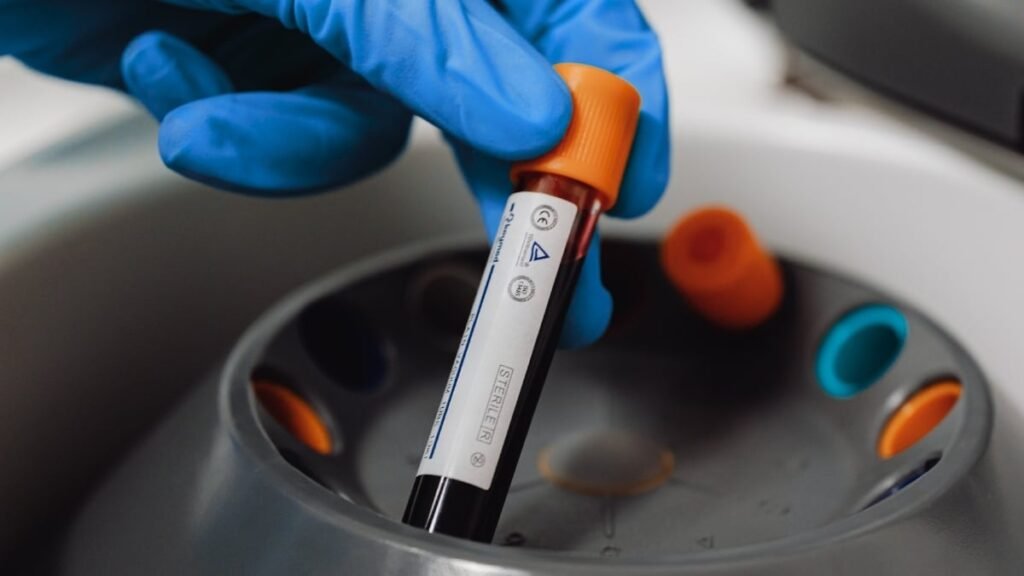 ‘Forever chemicals’ detected in 98.8% of human blood samples tested: ScienceAlert