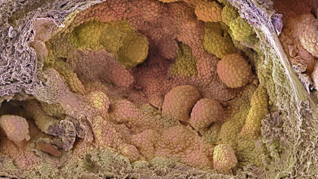 New hormonal protocol reduces risk of recurrence in prostate cancer clinical trial New hormonal protocol reduces risk of recurrence in prostate cancer clinical trial