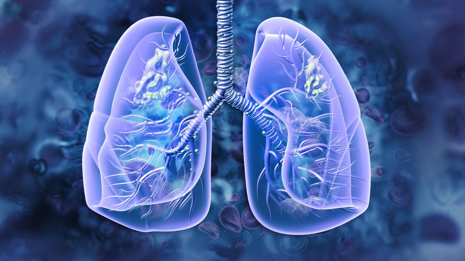 ASCO: Lilly links Retevmo to ‘dramatic’ outcomes in early-stage lung cancer using rare RET biomarker ASCO: Lilly links Retevmo to ‘dramatic’ outcomes in early-stage lung cancer using rare RET biomarker