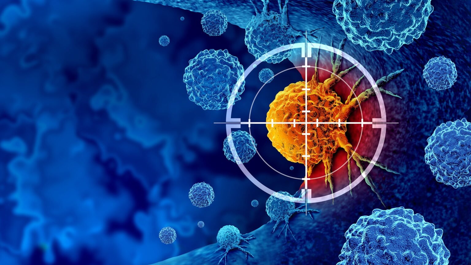 Radiopharmaceutical company Lanteus considers potential billion acquisition by Curium: Bloomberg Radiopharmaceutical company Lanteus considers potential billion acquisition by Curium: Bloomberg