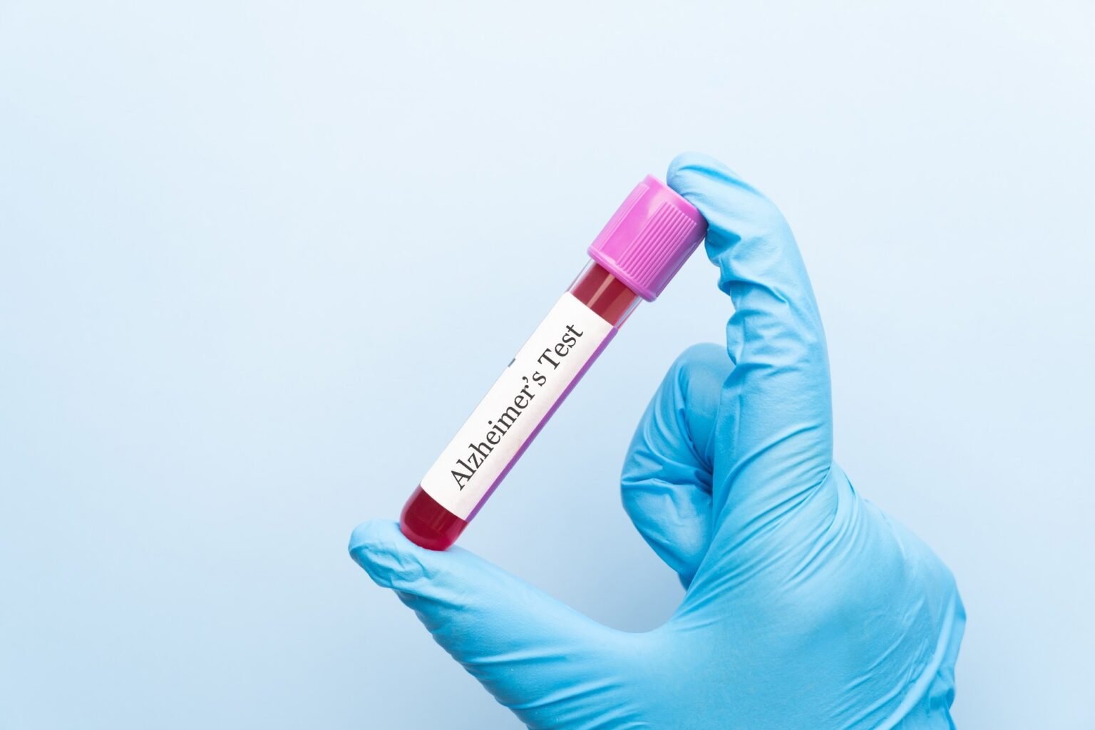 Identifying the age at which Alzheimer’s disease biomarkers change rapidly