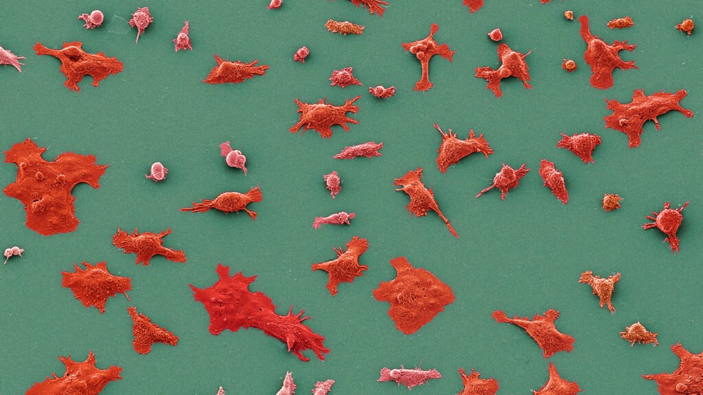 ‘Surprising results’ for Revolution Medicine’s pancreatic cancer drug ‘Surprising results’ for Revolution Medicine’s pancreatic cancer drug
