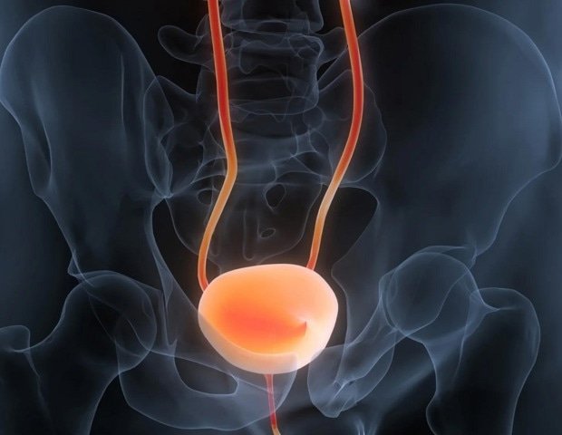 New peptide causes domino effect to suppress bladder cancer New peptide causes domino effect to suppress bladder cancer