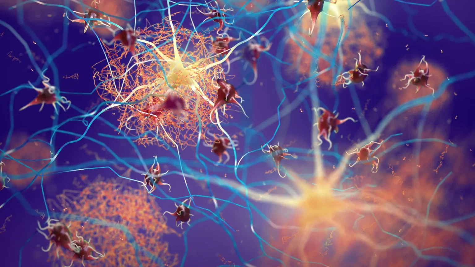 Increasing one protein can help the brain fight Alzheimer’s disease