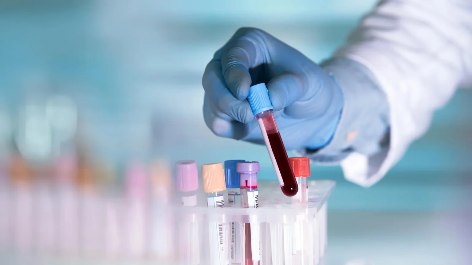 This simple blood test may detect depression before symptoms appear