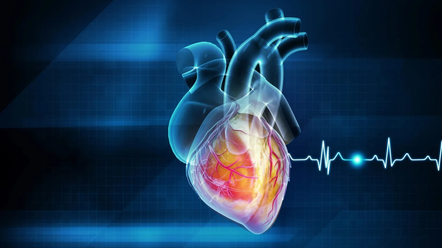 Popular GLP-1 weight loss drugs such as Ozempic reduce risk of heart attack and stroke Popular GLP-1 weight loss drugs such as Ozempic reduce risk of heart attack and stroke