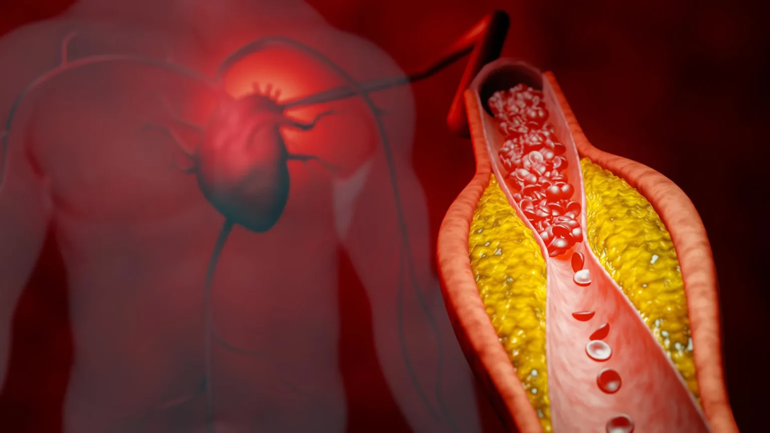 New treatment reduces bad cholesterol by nearly 50% without using statins