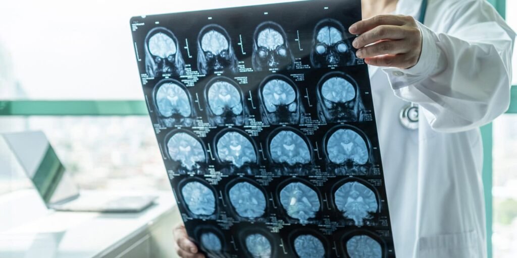Brain scan study reveals physical link to PTSD’s most distressing symptoms Brain scan study reveals physical link to PTSD’s most distressing symptoms