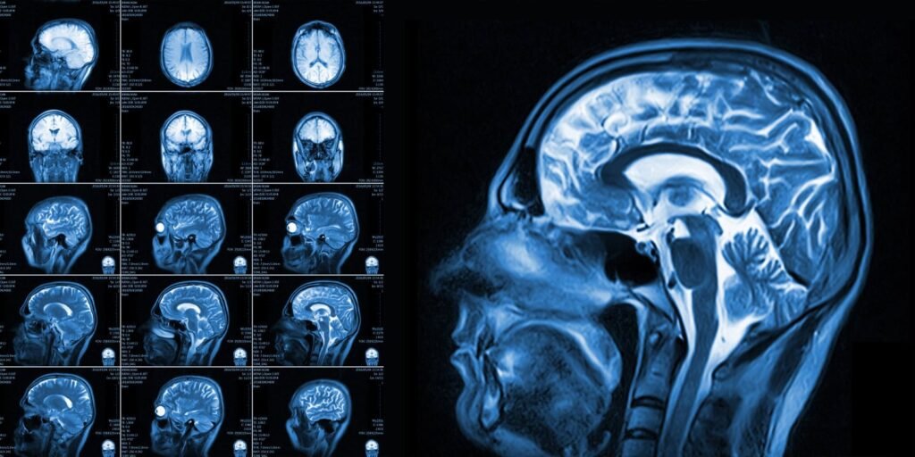 Early childhood brain network patterns are associated with early alcohol use
