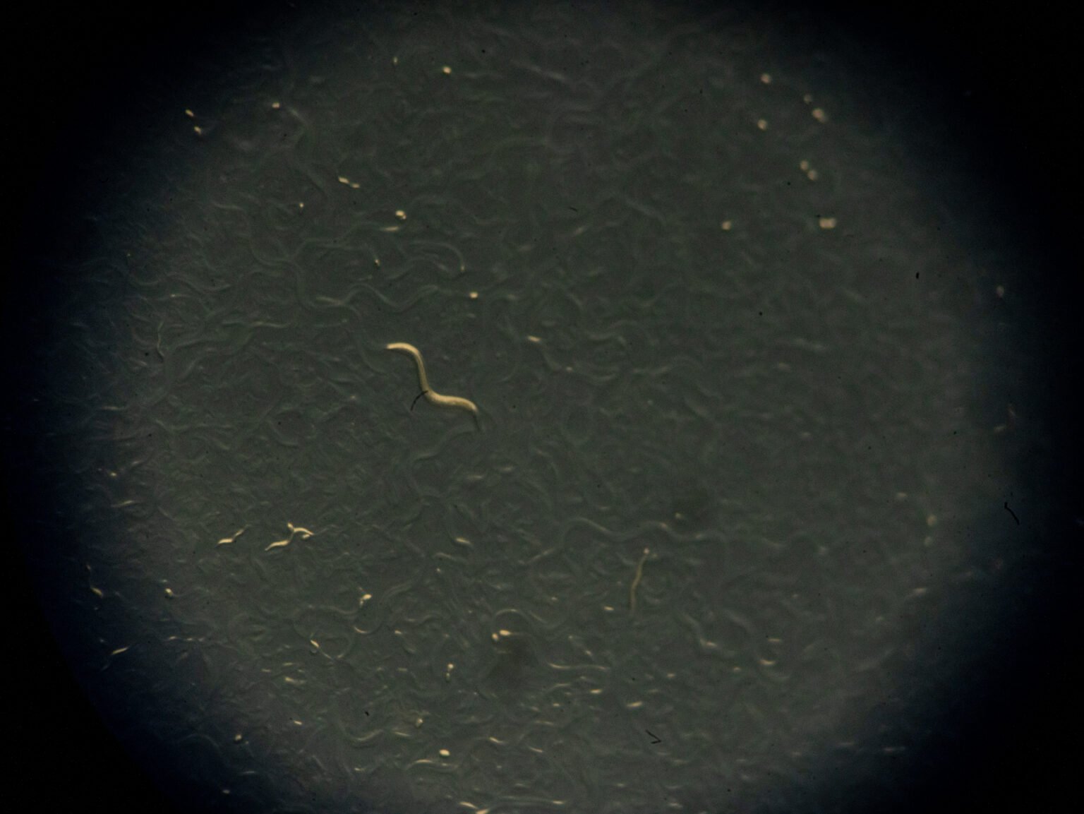Local researchers discover microplastics may act as toxin carriers Local researchers discover microplastics may act as toxin carriers