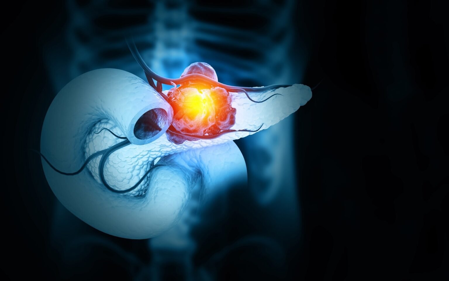 Triple-drug strategy permanently regresses pancreatic tumors