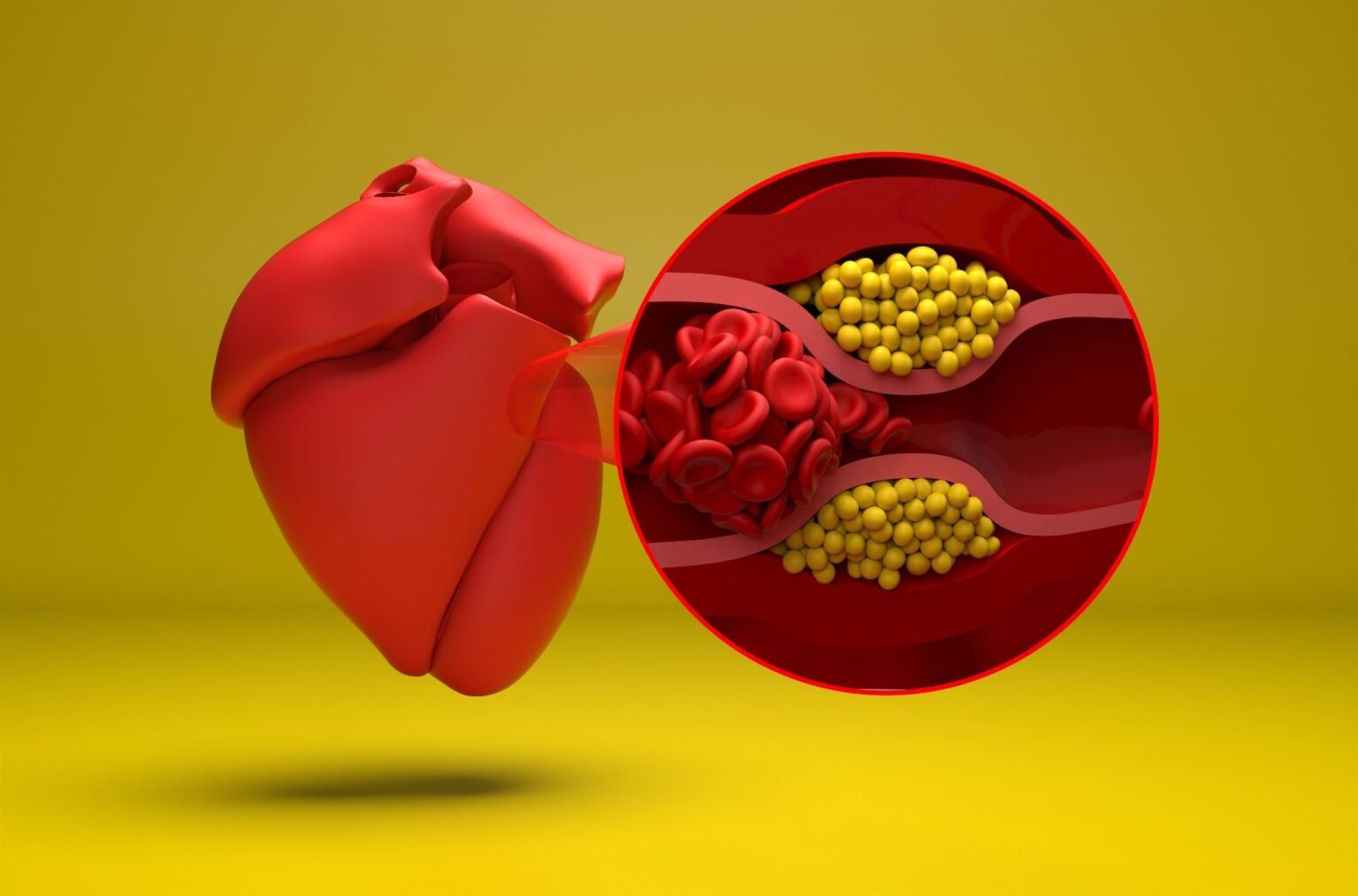 GLP-1 drugs may reduce blood clot-related risks in patients with chronic inflammation GLP-1 drugs may reduce blood clot-related risks in patients with chronic inflammation