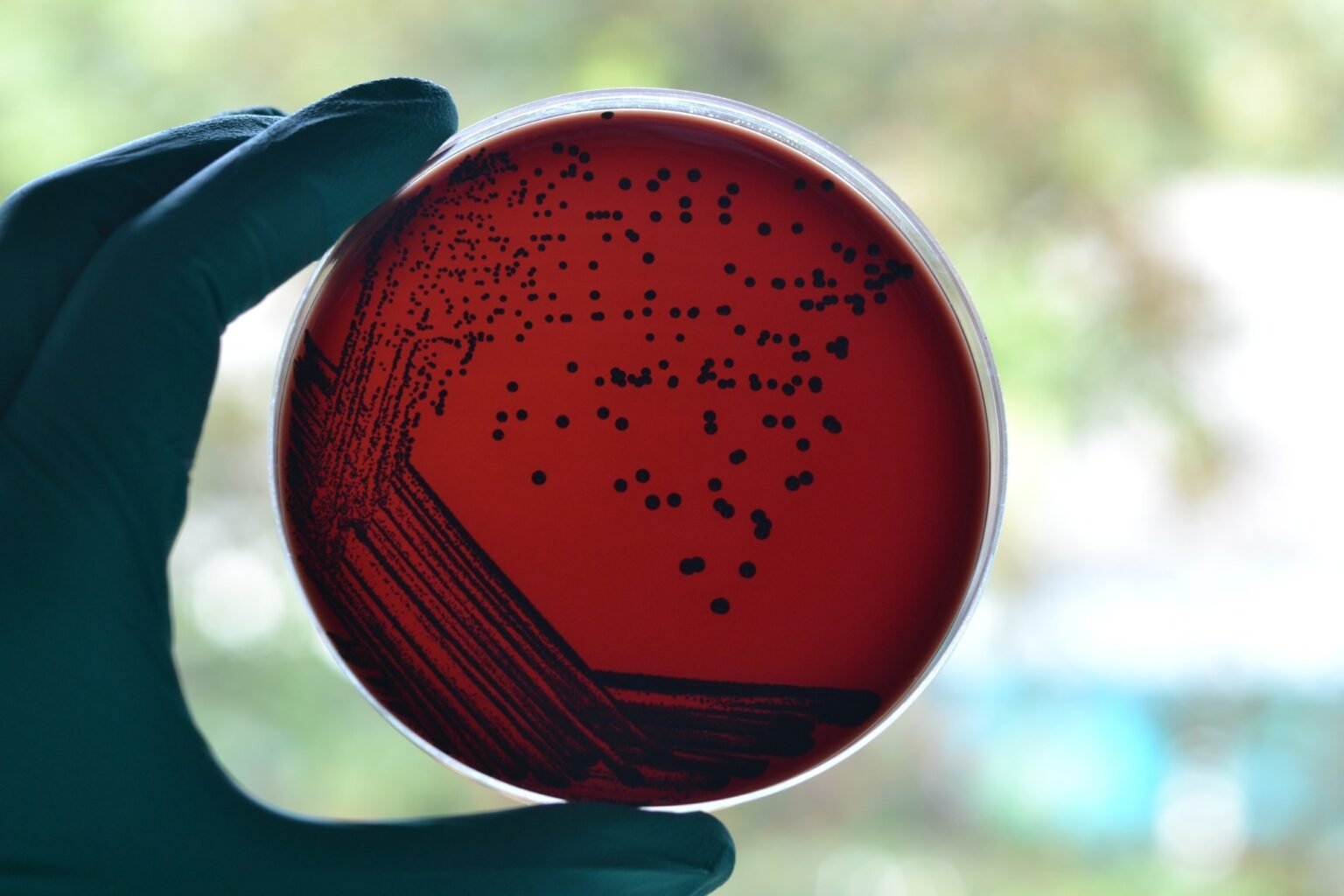 Diphtheria outbreak in Australia shows why boosters, antibiotics and better housing are important Diphtheria outbreak in Australia shows why boosters, antibiotics and better housing are important