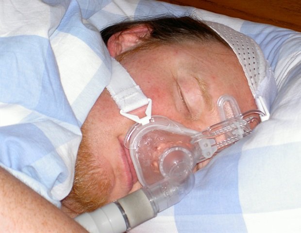 Bile acids modified by microbes influence sleep apnea outcome Bile acids modified by microbes influence sleep apnea outcome
