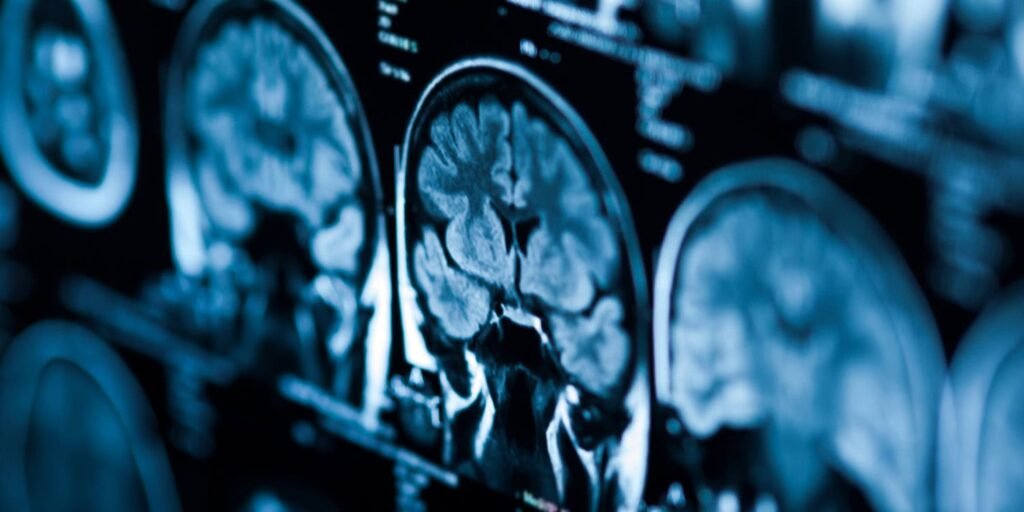 Indoor radon exposure is associated with changes in brain development in adolescents