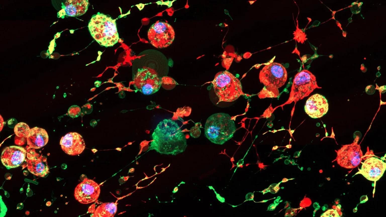 Scientists discover hidden ‘death footprints’ that could help virus spread