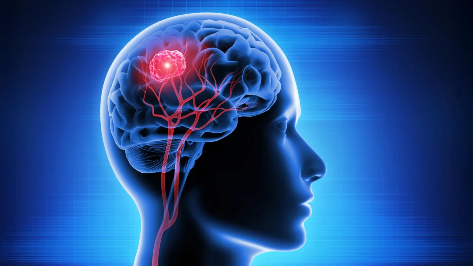 New vitamin B12 therapy shows promise against deadly brain tumors