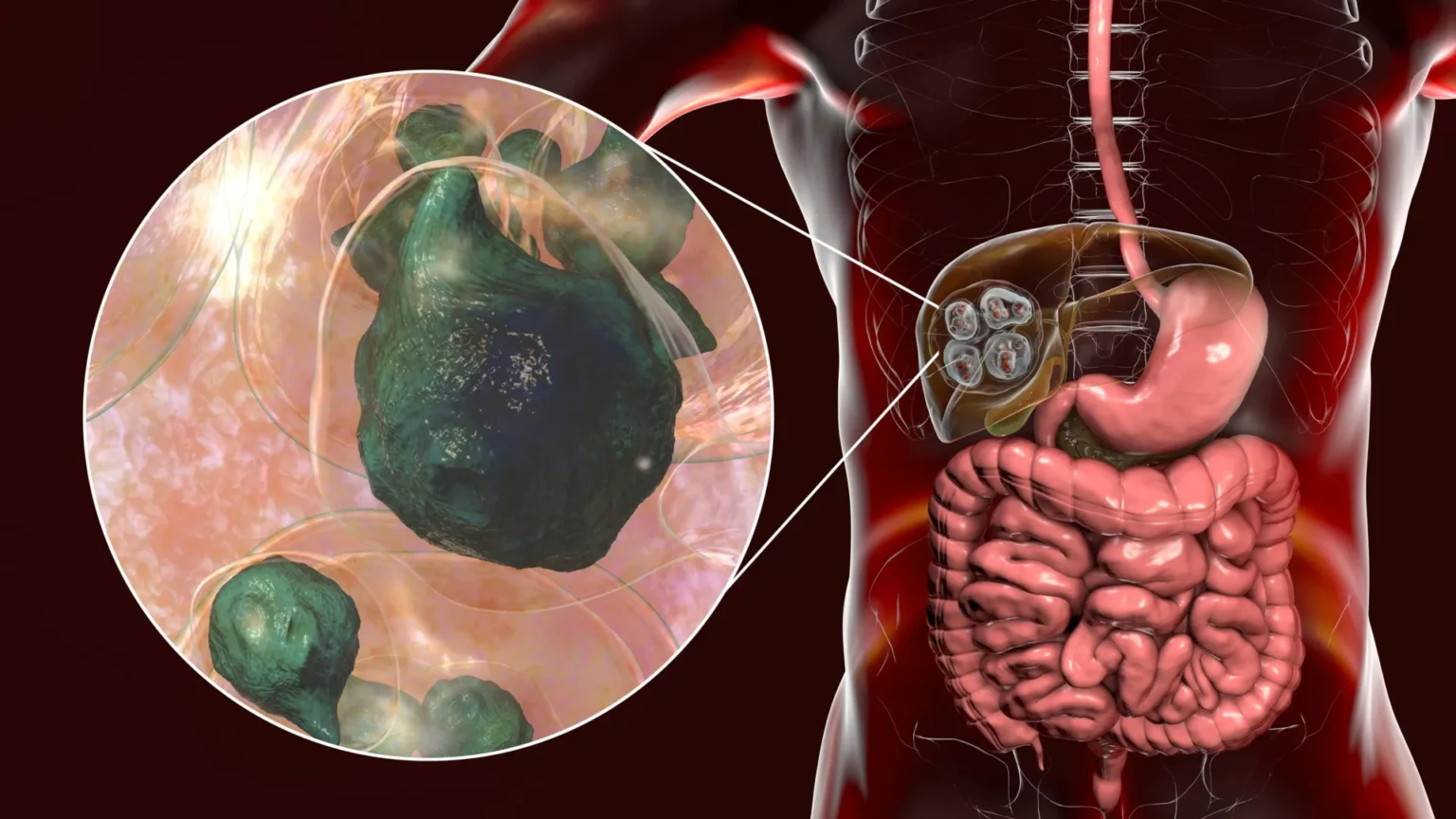 Deadly tapeworm spreading across America reaches Pacific Northwest Deadly tapeworm spreading across America reaches Pacific Northwest