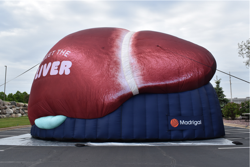 Madrigal takes giant inflatable liver on US tour for disease awareness Madrigal takes giant inflatable liver on US tour for disease awareness