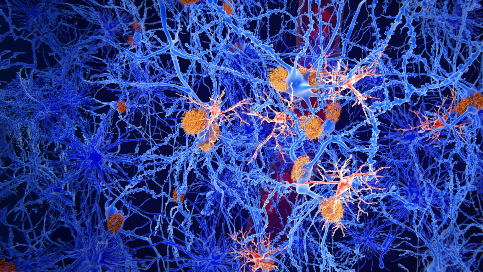 Scientists reprogram brain immune cells to fight Alzheimer’s disease