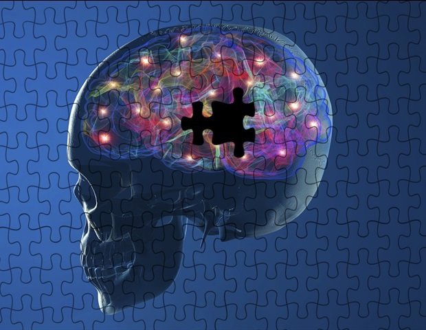 Stem cell-derived dopaminergic cell transplantation shows promising results in Parkinson’s disease Stem cell-derived dopaminergic cell transplantation shows promising results in Parkinson’s disease