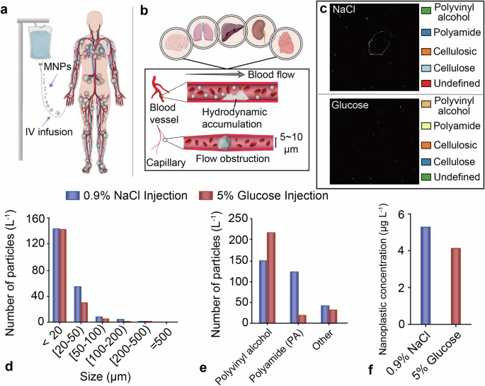 Clinical injection bypasses physiological barriers and delivers microplastics directly into human circulation Clinical injection bypasses physiological barriers and delivers microplastics directly into human circulation
