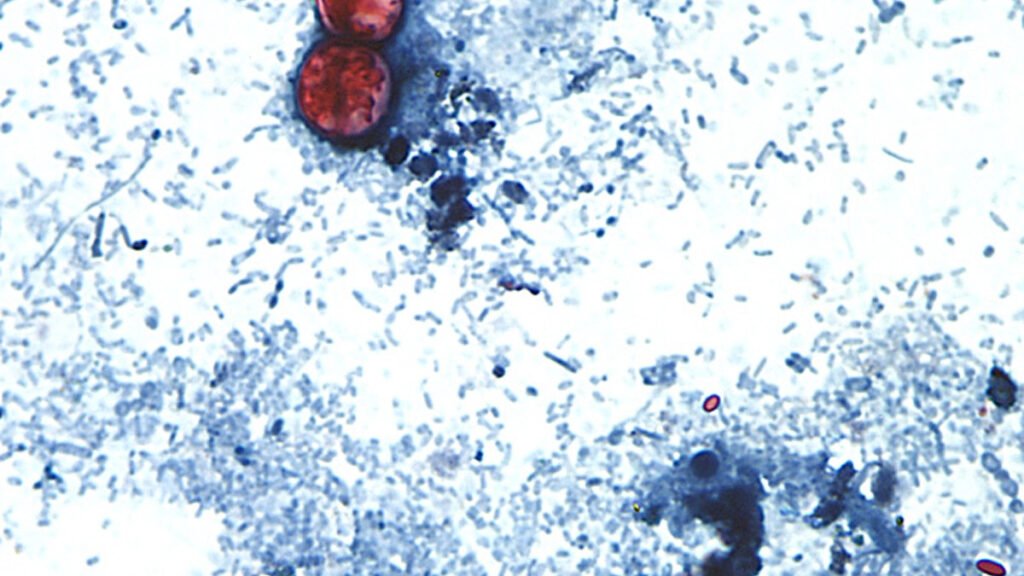 New Acospores, Peptide Panels, and Autism: Morning Rounds New Acospores, Peptide Panels, and Autism: Morning Rounds