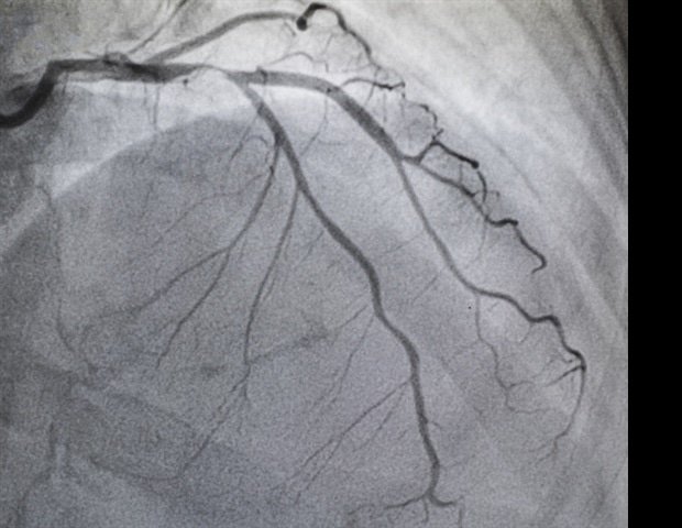 Streamline pulmonary embolism care communication with an innovative framework Streamline pulmonary embolism care communication with an innovative framework