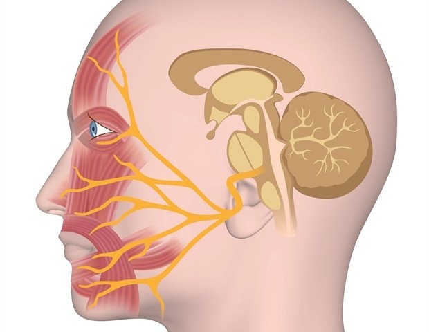 Gentle electroacupuncture effectively promotes nerve repair in facial paralysis Gentle electroacupuncture effectively promotes nerve repair in facial paralysis
