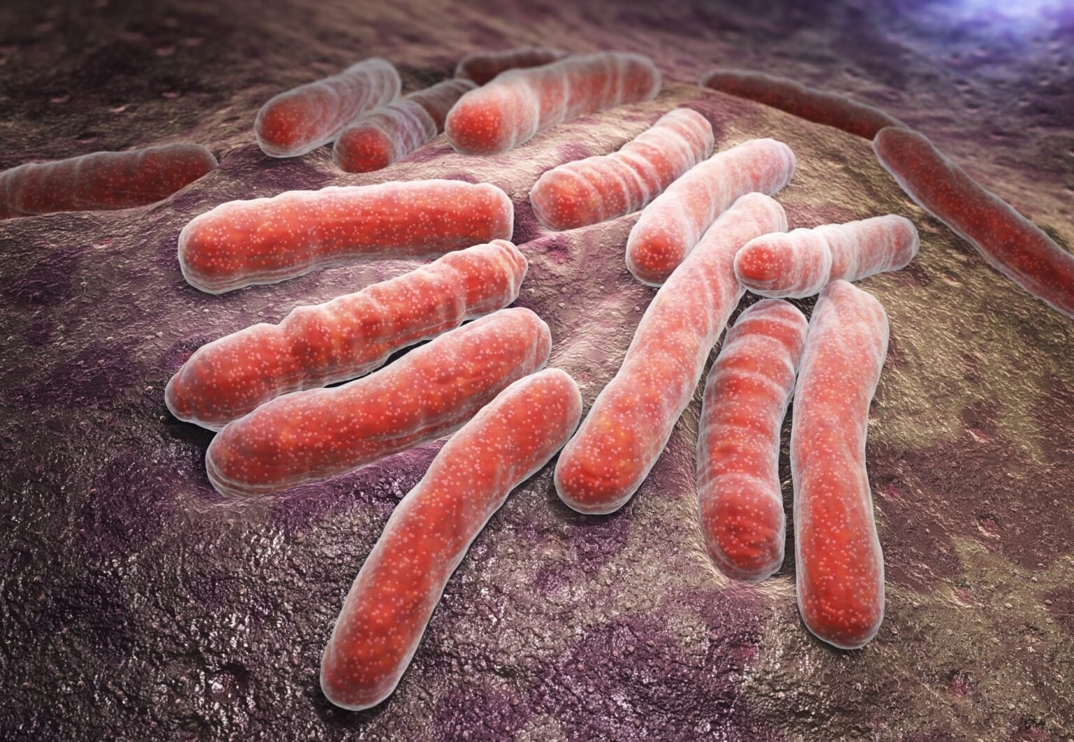 Study links severe COVID-19 to increased risk of tuberculosis, and vaccination appears to blunt the association