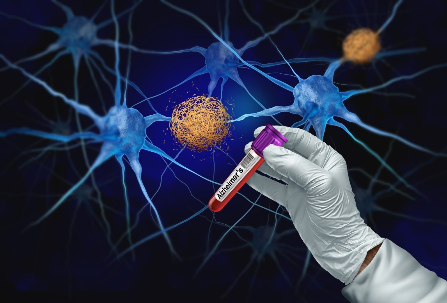 Blood p-tau217 levels indicate risk of cognitive impairment years before symptoms appear