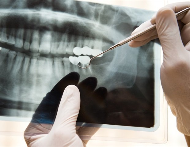 First diagnostic X-ray in space expands medical capabilities for astronauts First diagnostic X-ray in space expands medical capabilities for astronauts