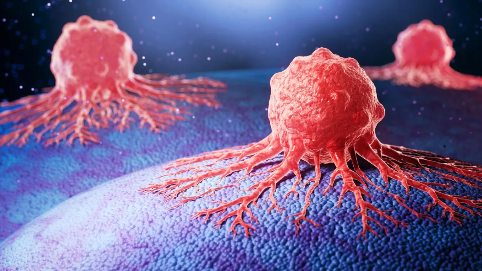 New antibody drug halts spread of aggressive prostate cancer New antibody drug halts spread of aggressive prostate cancer
