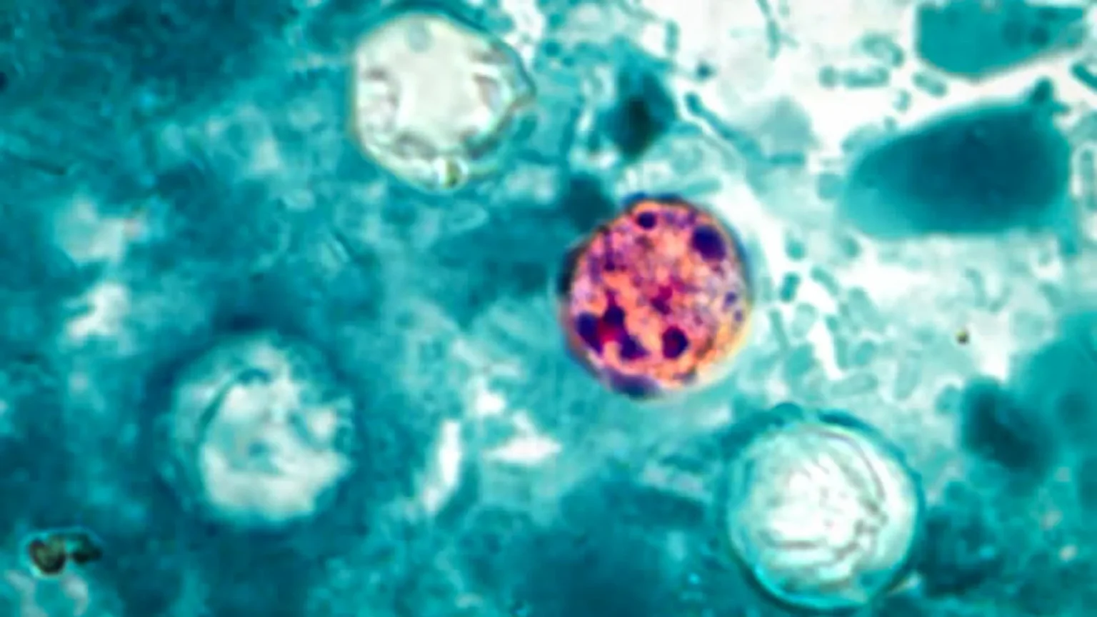 More than 400 people sickened as CDC investigates cause of mysterious outbreak More than 400 people sickened as CDC investigates cause of mysterious outbreak
