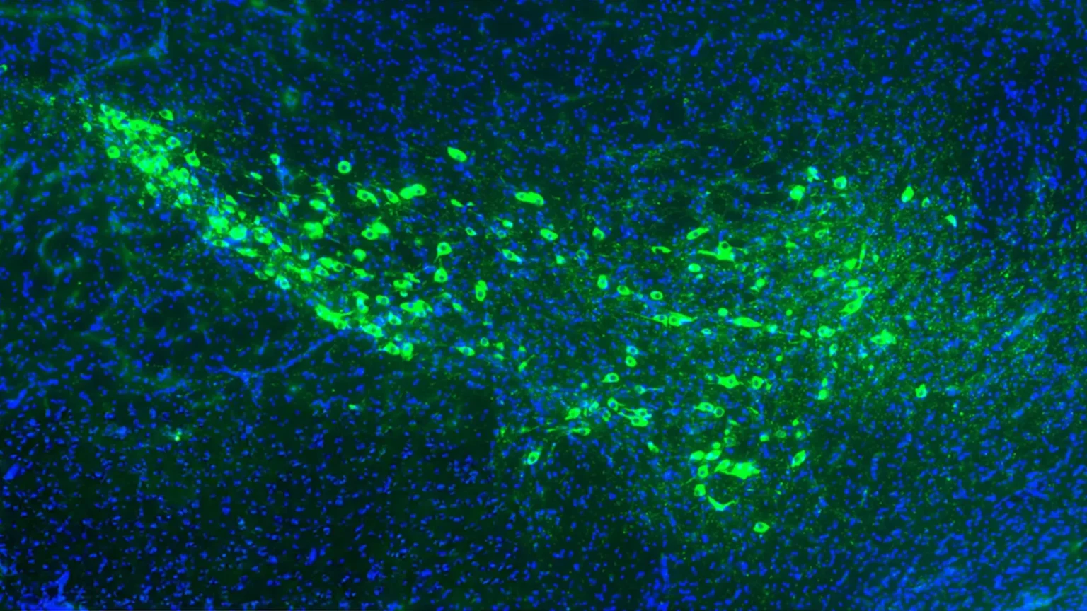 Yale scientists may have discovered how Parkinson’s disease spreads to the brain Yale scientists may have discovered how Parkinson’s disease spreads to the brain