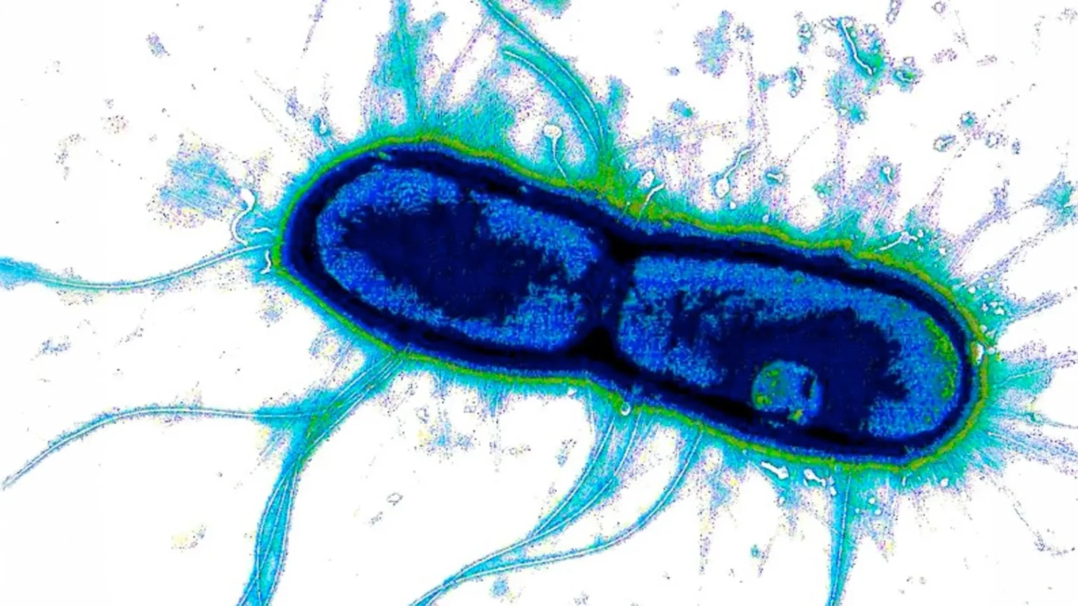 Scientists discover ‘Achilles heel’ of deadly gut bacteria